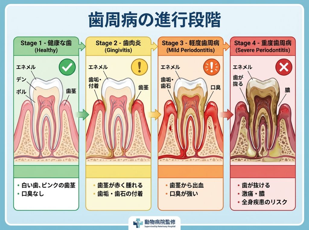 歯周病の進行段階